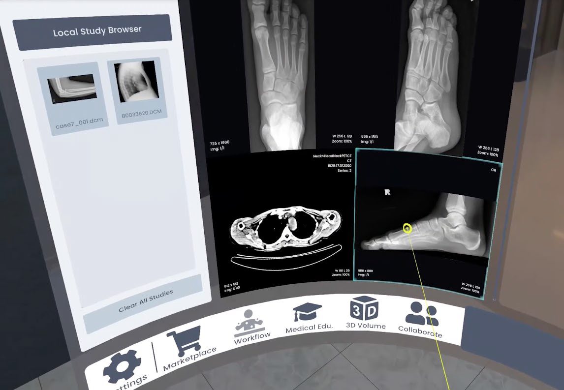 VR and XR in Medical Training: Luxsonic