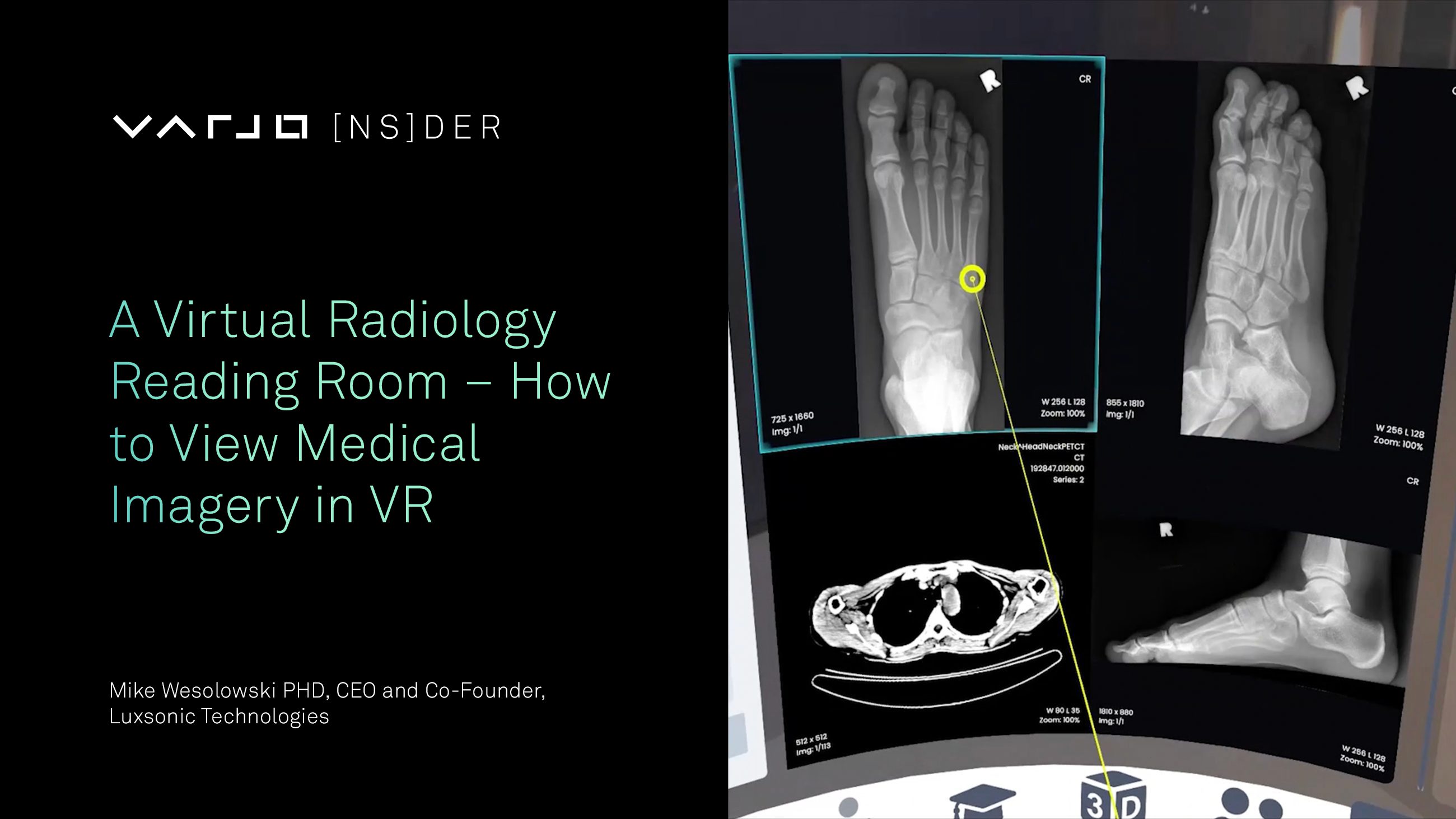A Virtual Radiology Reading Room – How to View Medical Imagery in VR